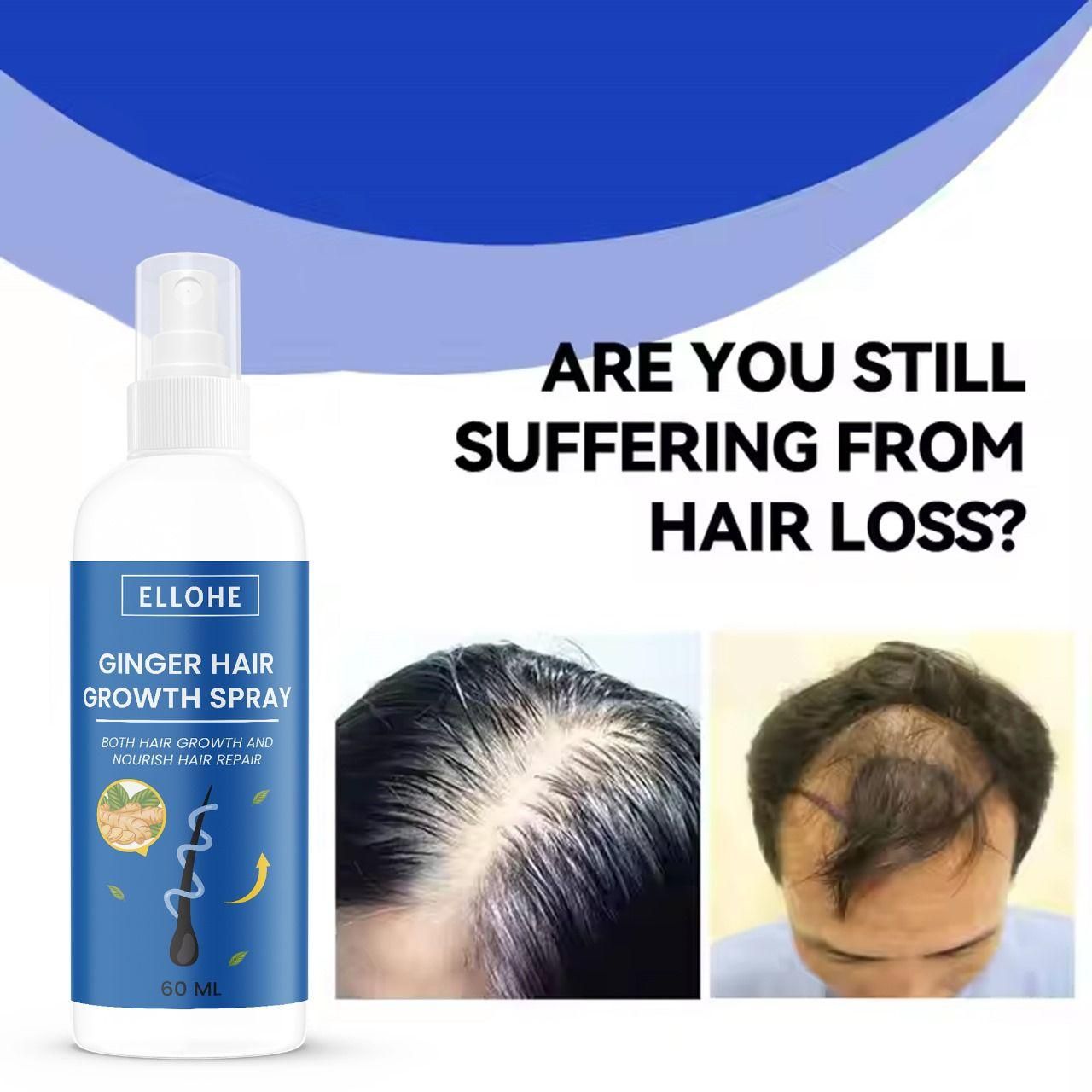 Ginger Hair Growth Spray (60 ML Pack of 2)