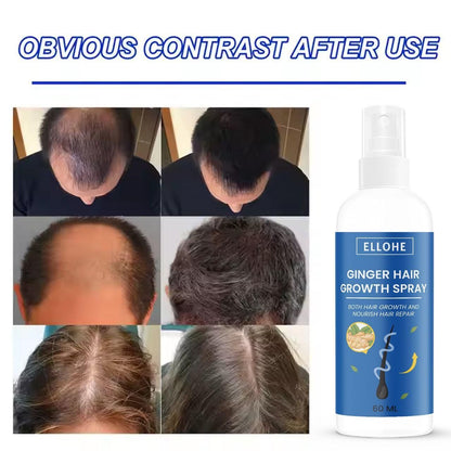 Ginger Hair Growth Spray (60 ML Pack of 2)