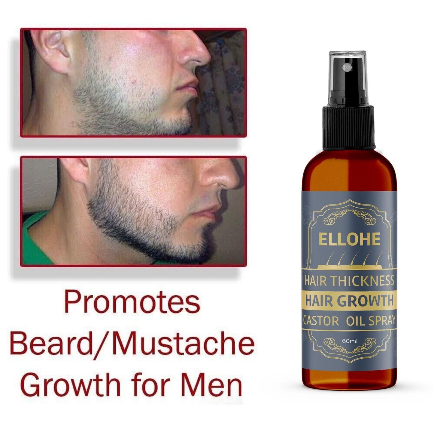 Hair Thickness & Hair Growth Castor Oil Spray (60ml Pack of 1)