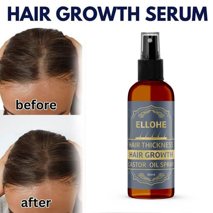 Hair Thickness & Hair Growth Castor Oil Spray (60ml Pack of 1)
