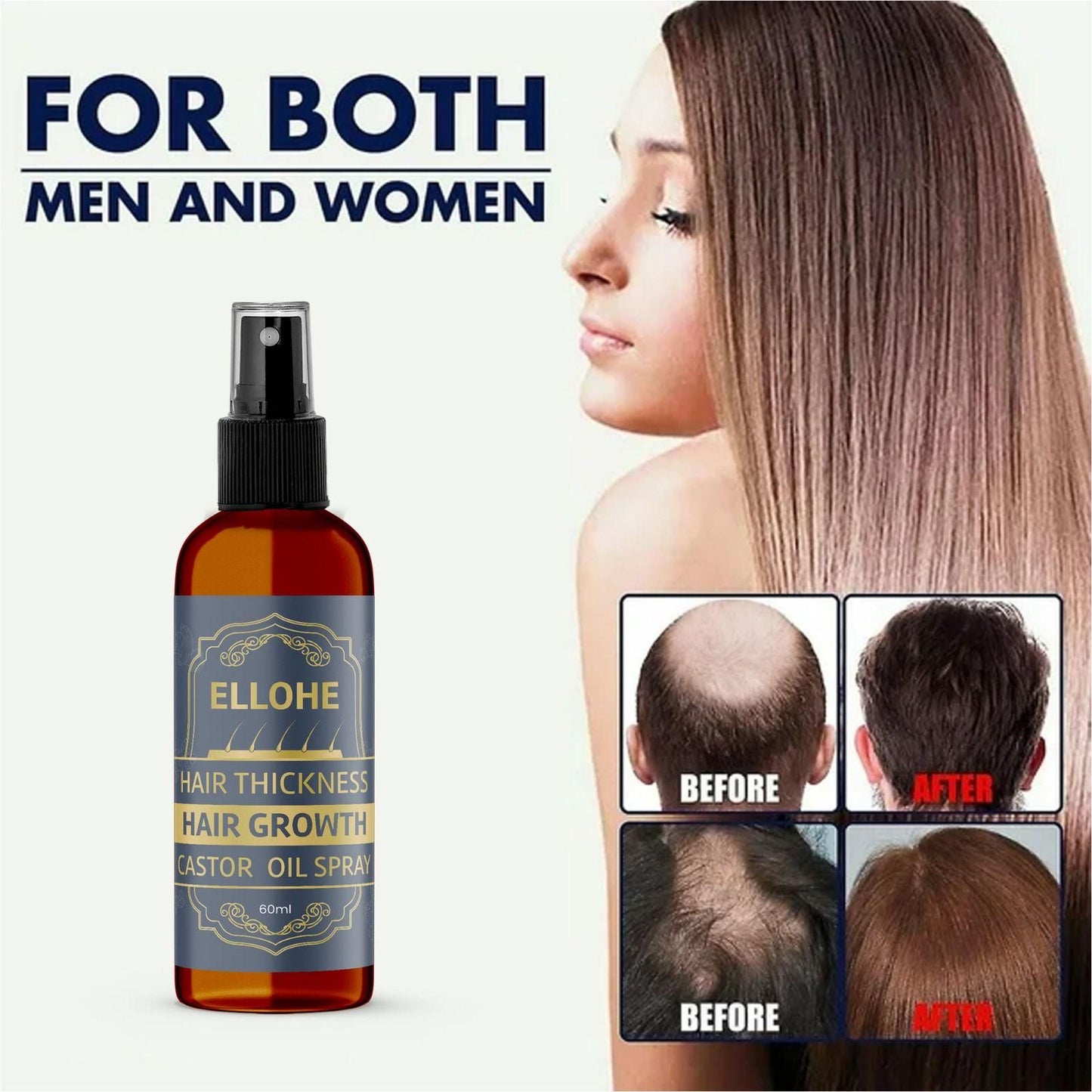 Hair Thickness & Hair Growth Castor Oil Spray (60ml Pack of 1)